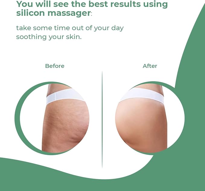 Anti Cellulite Massager Roller - Anticellulite Fascia Blaster for Cellulite Remover - Improves Blood Flow Use Cellulite Brush & Cellulite Roller with Cream or Oil for Cellulite Treatment